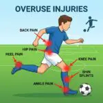 Overuse Injuries guide. illustration. Soccer Player